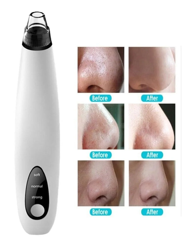VELVET PORE VACUUM PRO