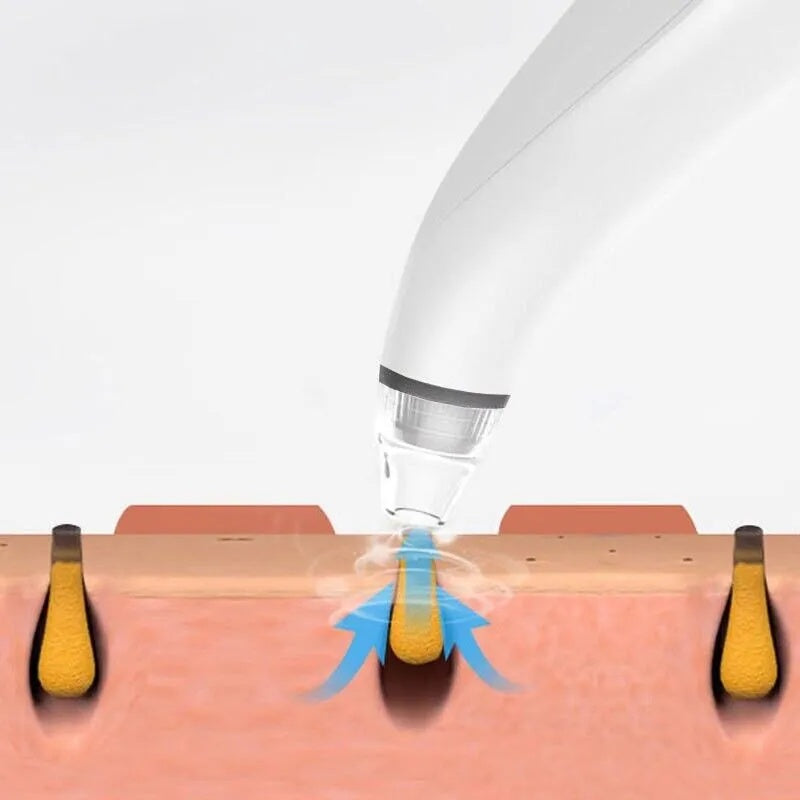 VELVET PORE VACUUM PRO